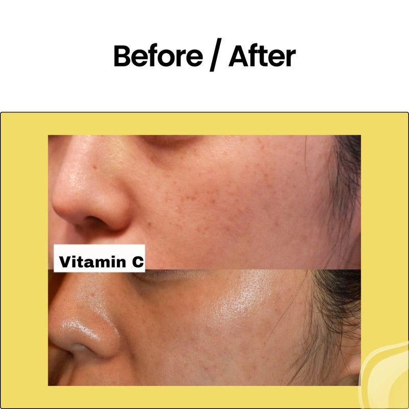 Luxe Radiance Vitamin C Serum